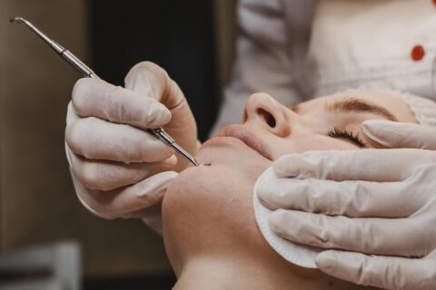Skin Tag Removal